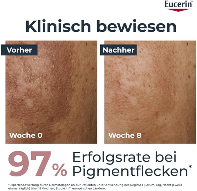 Eucerin Anti-Pigment Dual Serum 30ml - Image 2