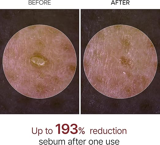 Dr.Melaxin Peel Shot Exfoliating White Rice Ampoule 80ml - Image 4