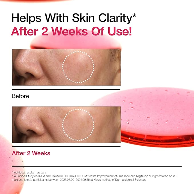 Anua Niacinamide 10%+txa 4% Serum 30ml - Image 6