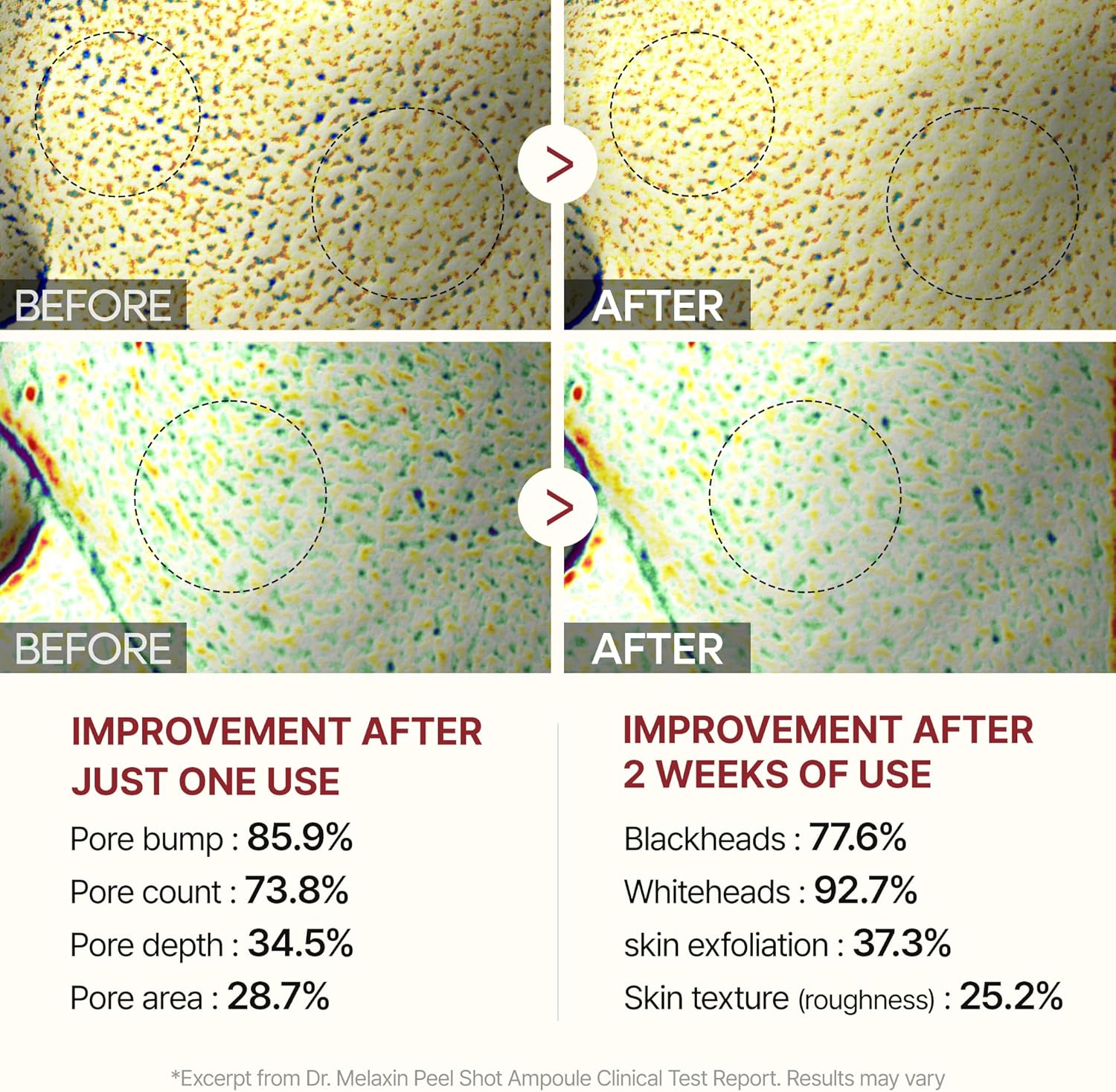 Dr.Melaxin Peel Shot Exfoliating White Rice Ampoule 80ml - Image 6